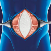 Cellis Visceral Datenblatt
