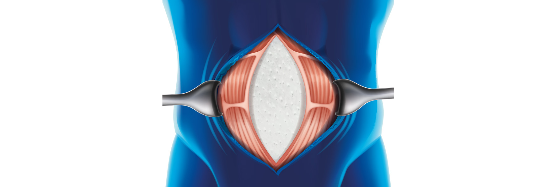 Cellis Visceral Datenblatt
