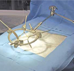 Bookler & Mini Bookler System